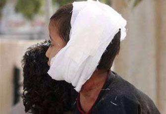 الصورة غير متاحة