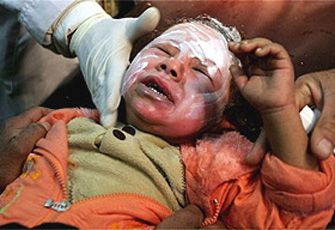 الصورة غير متاحة