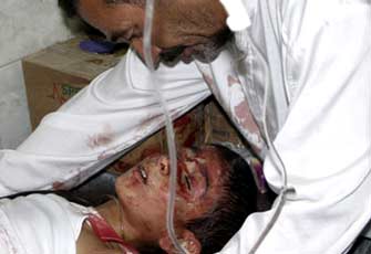 الصورة غير متاحة