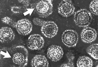 الصورة غير متاحة