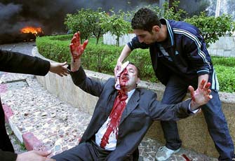 الصورة غير متاحة