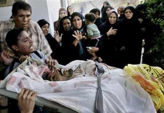 الصورة غير متاحة