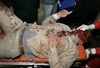 الصورة غير متاحة