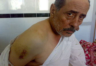 الصورة غير متاحة