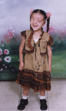 الصورة غير متاحة