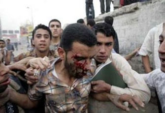 الصورة غير متاحة