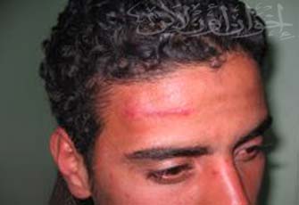 الصورة غير متاحة