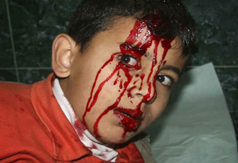 الصورة غير متاحة