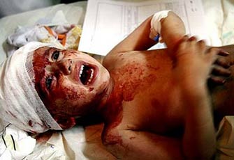 الصورة غير متاحة