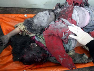 الصورة غير متاحة