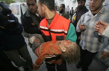 الصورة غير متاحة