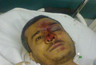 الصورة غير متاحة