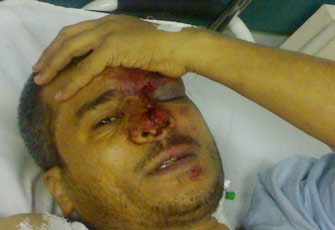 الصورة غير متاحة