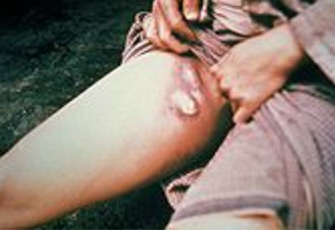 الصورة غير متاحة