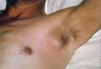 الصورة غير متاحة