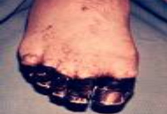 الصورة غير متاحة