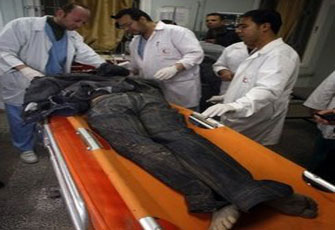 الصورة غير متاحة