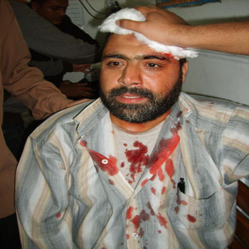 الصورة غير متاحة