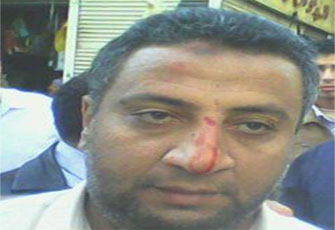 الصورة غير متاحة