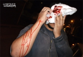 الصورة غير متاحة