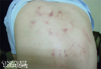 الصورة غير متاحة