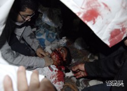 مصابو التحرير في أحداث 20 نوفمبر