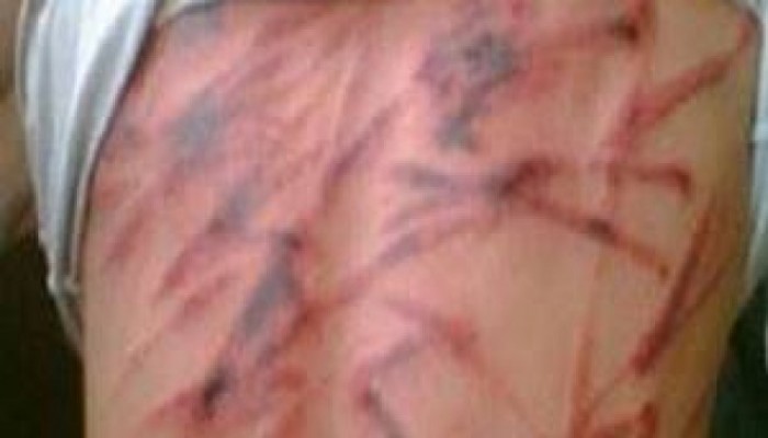 مركز الشهاب يرصد أبرز انتهاكات حقوق الإنسان في مايو 2018