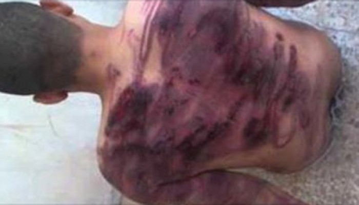 أسرة المعتقل محمود الصوفاني تحمل الانقلاب مسئولية سلامته