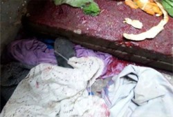 ميليشيات الانقلاب نعتقل "جثة مواطن بعد قتله بناهيا