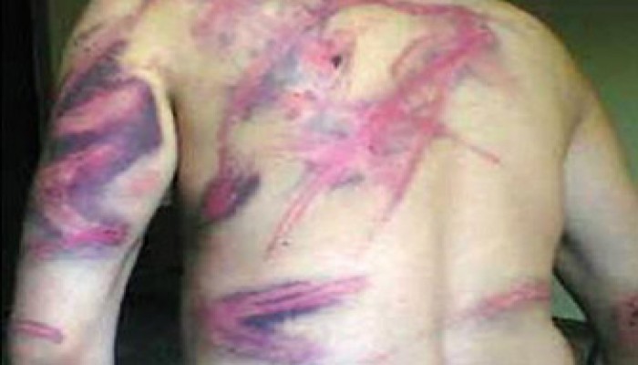 فيديو.. زوجة معتقل معاق بالشرقية تفضح جرائم الانقلاب بحقه