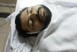 استشهاد أحد مصابي مجزرة فض اعتصام النهضة متأثرًا بإصابته