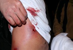 الانقلاب يعتدي على مسيرة بالزقازيق ويعتقل عشرات الثوار
