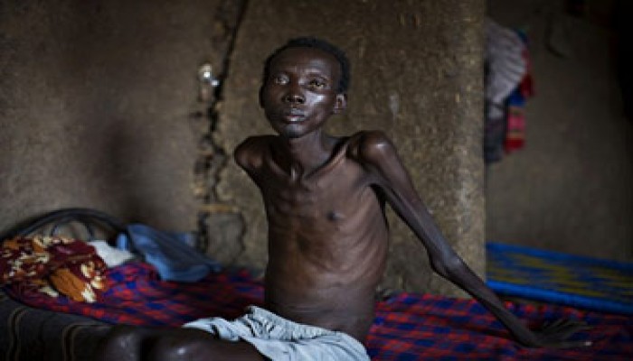 ثلث سكان جنوب السودان معرضون للمجاعة