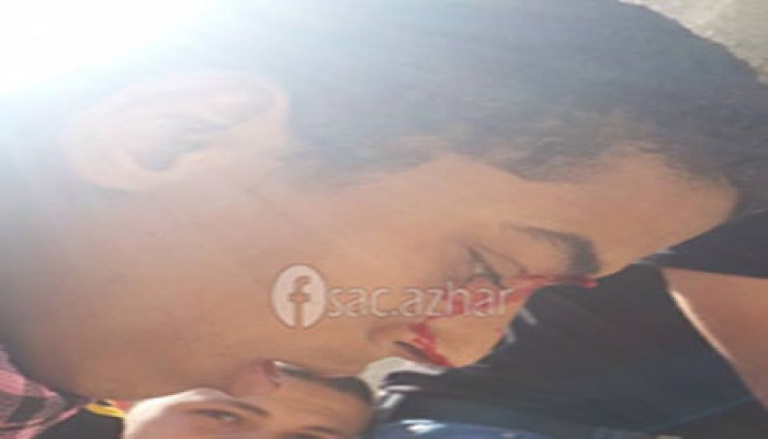 اقتحام المدينة الجامعية للأزهر وإصابات كبيرة في صفوف الطلاب