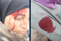 اعتداءات وحشية على طالبات الأزهر بالغاز والخرطوش