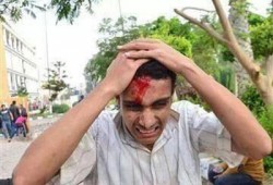 الانقلاب يعتدي على مظاهرة طلاب الأزهر بالمدينة الجامعية