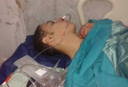 ميليشيات الانقلاب تصيب وتعتقل طالبًا مصابًا بجامعة المنيا!!