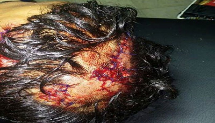 المتحدث باسم طلاب ضد الانقلاب: جامعة الزقازيق تحولت إلى وكر للبلطجية