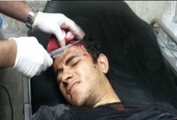 اعتداءات وحشية بجامعة الزقازيق.. والطلاب: مستمرون في حراكنا الثوري