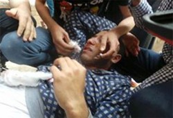 بالصور.. مليشيات الانقلاب تعتدي على طلاب عين شمس وإصابات بالجملة