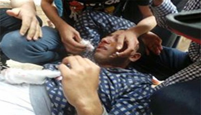 بالصور.. مليشيات الانقلاب تعتدي على طلاب عين شمس وإصابات بالجملة