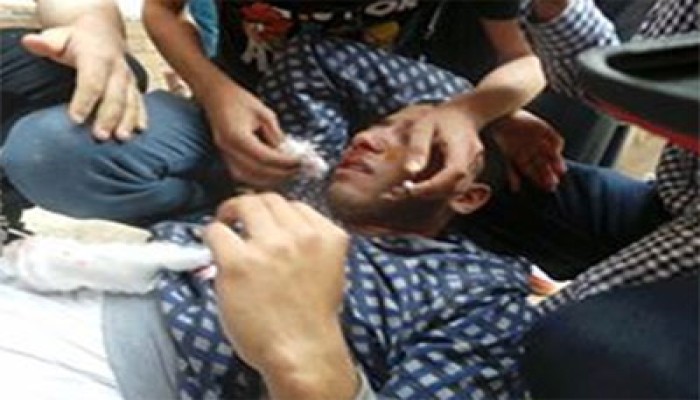 بالصور.. مليشيات الانقلاب تعتدي على طلاب عين شمس وإصابات بالجملة