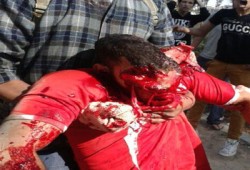 استشهاد طالب بالمدينة الجامعية للأزهر بالرصاص الحي