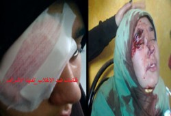 إصابات بالجملة في اعتداء الانقلاب على طلاب أزهر "تفهنا الأشراف"