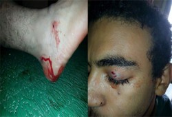 عشرات الإصابات بـ"ميداني" الأزهر بعد إطلاق الغاز والخرطوش