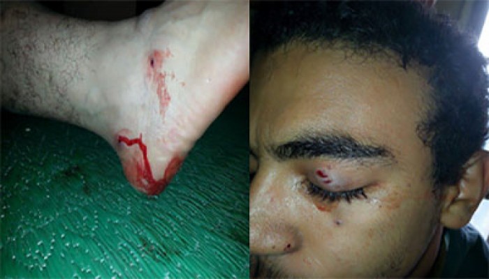 عشرات الإصابات بـ"ميداني" الأزهر بعد إطلاق الغاز والخرطوش