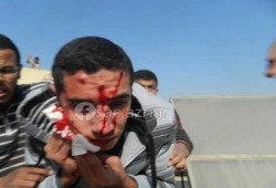 بالصور.. إصابة عشرات من طلاب الأزهر بالخرطوش