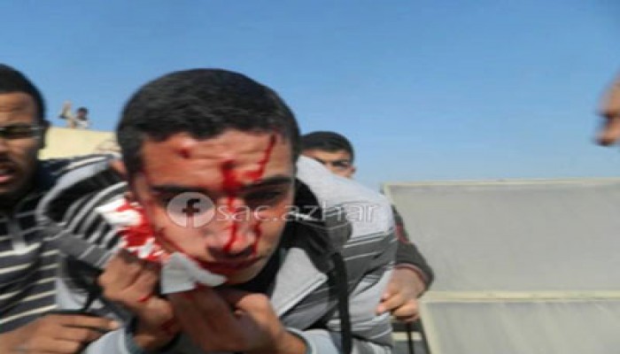 بالصور.. إصابة عشرات من طلاب الأزهر بالخرطوش