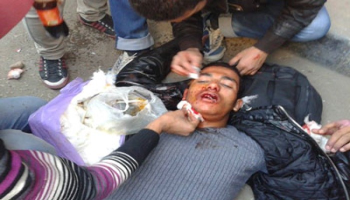 أسيوط.. إصابة طلاب 9 بالخرطوش واختطاف 7 آخرين بشارع الجمهورية