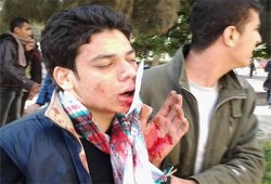 عشرات الإصابات في صفوف طلاب الأزهر بالمدينة الجامعية بالقاهرة